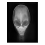 Alien-Röntgenstrahl Postkarte