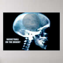 Basketball-Kopf (Röntgenstrahl) Posterdruck