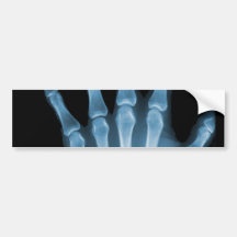 Blaue Röntgenstrahl-Skelett-Hand Auto Aufkleber