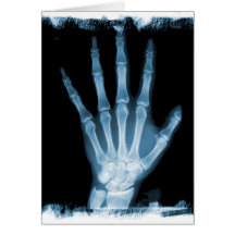 Blaue Röntgenstrahl-Skelett-Hand Grußkarten