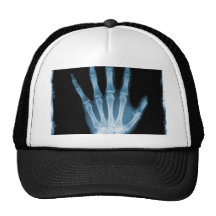 Blaue Röntgenstrahl-Skelett-Hand Netzkappe