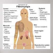 Diagramm der Symptome von Fibromyalgia Posterdruck