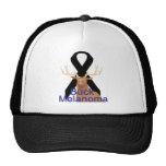 Dollar-Melanom-Hut Retro Cap