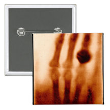 Erste X-Ray, 1901, Fotografie Anstecknadel