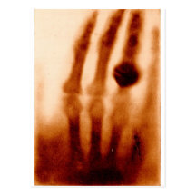 Erste X-Ray, 1901, Fotografie Postkarte