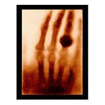 Erste X-Ray, 1901, Fotografie Postkarten