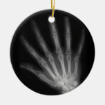 Extrastellen-Röntgenstrahl-links Hand Weihnachtsornament