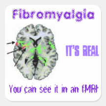 Fibromyalgia ist wirklich. fMRI Beweis Sticker