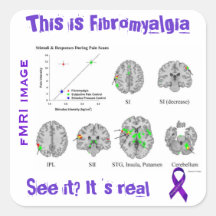 Fibromyalgia ist wirklich. Sie können ihn auf eine Sticker
