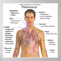 Hauptsymptome des ansteckenden Pneumonie-Diagramms Plakate