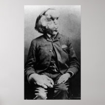 Joseph "John" Merrick Elephant Man ab 1889 Plakatdrucke