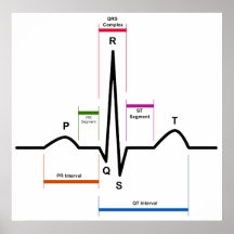 Kurve-Rhythmus in einem Diagramm des Elektrokardio Posterdrucke