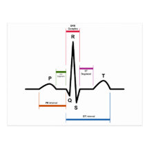 Kurve-Rhythmus in einem Diagramm des Elektrokardio Postkarten