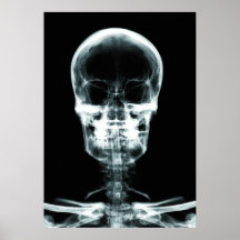 RÖNTGENBLICK-SKELETON SCHÄDEL - VORLAGE POSTERDRUCK