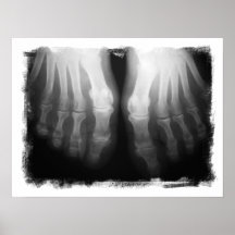 Röntgenstrahl-Fuß-menschliches Skeleton Knochen-Sc Poster