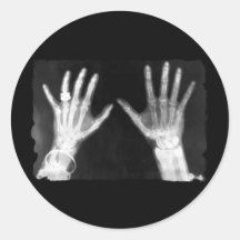 Röntgenstrahl-Skeleton Hände u. Schmuck - B&W Runder Aufkleber