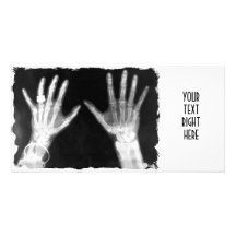 Röntgenstrahl-Skeleton Hände u. Schmuck - B&W Photokarte