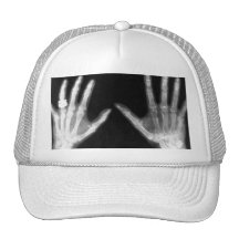 Röntgenstrahl-Skeleton Hände u. Schmuck - B&W Kultcaps
