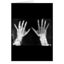Röntgenstrahl-Skeleton Hände u. Schmuck - B&W Karte