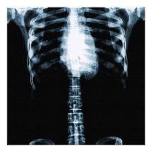 RÖNTGENSTRAHL-SKELETON TORSO-RIPPEN - BLAU ANKÜNDIGUNG