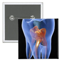 Zahn, transparenter Querschnitt eines Molars Anstecknadelbuttons