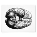 Suche nach gehirn anatomie poster Neurologie