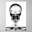 Suche nach radiologie poster Xray