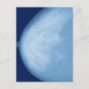 Suche nach körperteile postkarten Röntgenbild