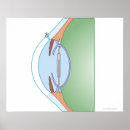 Suche nach präzision poster Arztplakate