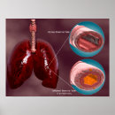 Suche nach lungs poster Medicine