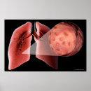 Suche nach lungen poster Teil