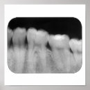 Suche nach zahn poster Medizin