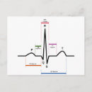 Suche nach ekg postkarten Elektrokardiogramm