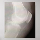 Suche nach arthritis poster Orthopädisch