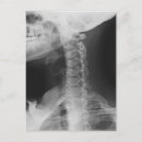 Suche nach röntgen postkarten Radiologie