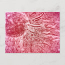 Suche nach sexuell postkarten Ovum