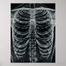 Suche nach xray poster Skelett
