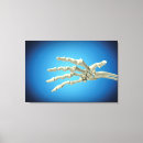 Suche nach gelenk leinwandbilder Menschliche gelenke