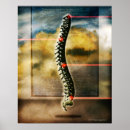 Suche nach wirbelsäule poster Rückenschmerzen