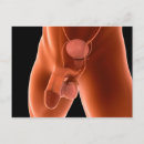 Suche nach urin postkarten Komplexität