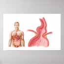 Suche nach torso poster Körper