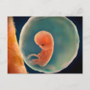 Suche nach embryo postkarten Plazenta
