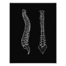 Suche nach wirbelsäule kunst Anatomie