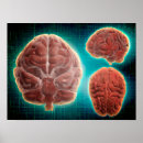 Suche nach neurologie poster Neuroanatomie