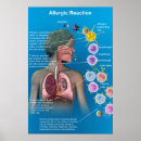 Suche nach reaktion poster Allergie