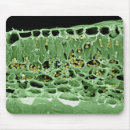 Suche nach falsche farbe mousepads Elektronmikrographie