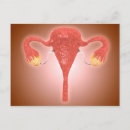 Suche nach uterus postkarten Gesundheitsfürsorge