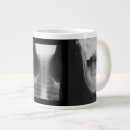 Suche nach röntgen tassen Radiologie