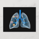 Suche nach organe postkarten Trachealringe