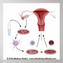 Suche nach embryo poster Sperma